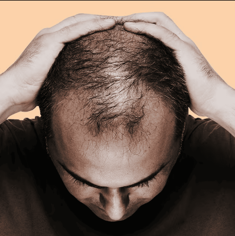 قرص برای تقویت و ضخیم شدن مو 